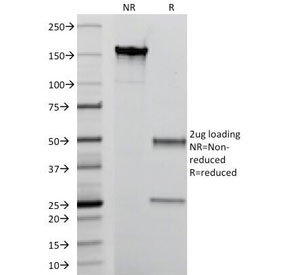 SDS-PAGE Analysis of Purified, BSA-Free MRP14 Antibody (clone MAC387). Confirmation of Integrity and Purity of the Antibo