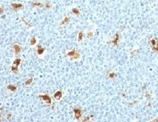 IHC: Formalin-fixed, paraffin-embedded human tonsil stained with S100A9 antibody (clone S100A9/1011).