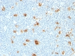 IHC: Formalin-fixed, paraffin-embedded human tonsil stained with Calgranulin A + B antibody (CAGB/426)