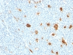 IHC: Formalin-fixed, paraffin-embedded human tonsil stained with MRP14 antibody (MRP14/840)