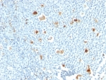 IHC: Formalin-fixed, paraffin-embedded human tonsil stained with Calprotectin antibody (CPT/1028)