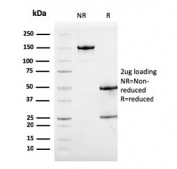SDS-PAGE analysis of purified, BSA-free S100A9 antibody (clone S100A9/1075) as confirmation of integrity and purity.