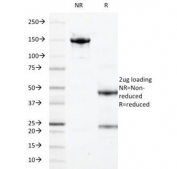 SDS-PAGE Analysis of Purified, BSA-Free S100A9 Antibody (clone 47-8D3). Confirmation of Integrity and Purity of the Antibody.