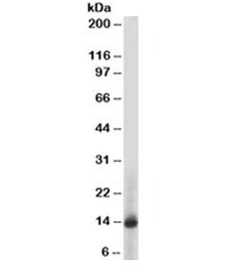Western blot testing of human PBM lysate with S100A9 antibody (clone 47-8D3). Expected/observed molecular weight ~14kDa.~