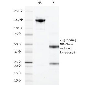 SDS-PAGE Analysis of Purified, BSA-Free S100A9 Antibody (clone 47-8D3). Confirmation of Integrity and Purity of the