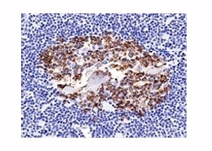 IHC analysis of formalin-fixed, paraffin-embedded normal human spleen stained with CDw75 antibody (clone LN1).~