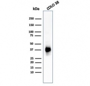 Western blot testing of human COLO-38 cell lysate with PMEL17 antibody (clone PMEL/783).