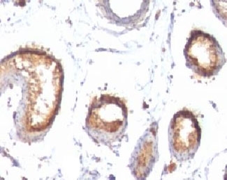 IHC: Formalin-fixed, paraffin-embedded human testis stained with PMEL17 antibody (PMEL/783).