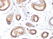 IHC: Formalin-fixed, paraffin-embedded human testis stained with gp100 antibody cocktail (HMB45 + PMEL/783). HIER: boil tissue sections in pH 9 10mM Tris with 1mM EDTA for 20 min and allow to cool before testing.
