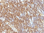 IHC: Formalin-fixed, paraffin-embedded human tonsil stained with SUMO-2 antibody (SUMO2/1199)
