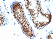 IHC: Formalin-fixed, paraffin-embedded human testicular carcinoma stained with SUMO-2 antibody.