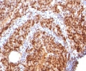 IHC: Formalin-fixed, paraffin-embedded rat ovary stained with SUMO-2 antibody.