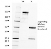 SDS-PAGE Analysis of Purified, BSA-Free Fascin Antibody (clone FSCN1/416). Confirmation of Integrity and Purity of the Antibody.