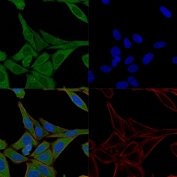 Immunofluorescent staining of permeabilized human HeLa cells with Fascin antibody (clone FSCN1/417, green), Phalloidin (actin, red) and Hoescht (nucleus, blue).
