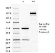 SDS-PAGE analysis of purified, BSA-free Fascin antibody (clone FSCN1/417) as confirmation of integrity and purity.