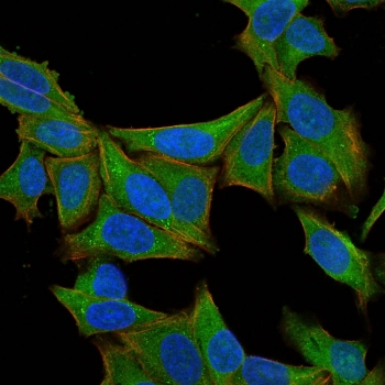Immunofluorescent staining of permeabilized human HeLa cells with Fascin antibody (clone SPM133, green), Phalloidin (actin, red) and Hoescht (nucleus, blue).