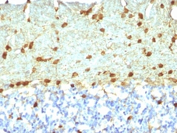 IHC: Formalin-fixed, paraffin-embedded rat brain stained with Fascin antibody (FSCN1/418)~