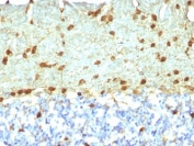 IHC: Formalin-fixed, paraffin-embedded rat brain stained with Fascin antibody (FSCN1/418)