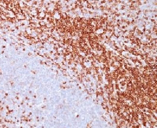 IHC: Formalin-fixed, paraffin-embedded human spleen stained with CD43 antibody (SPN/839).~