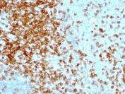IHC analysis of formalin-fixed, paraffin-embedded human tonsil stained with CD43 antibody (clone 84-3C1).