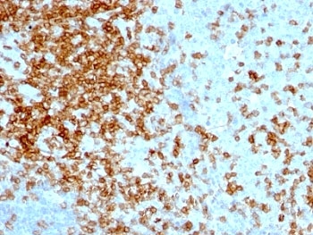 IHC analysis of formalin-fixed, paraffin-embedded human tonsil stained with CD43 antibody (clone 84-3C1).~