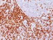 IHC: Formalin-fixed, paraffin-embedded human spleen stained with CD43 antibody (clone Bra7G).