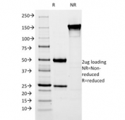 SDS-PAGE analysis of purified, BSA-free Estrogen Inducible Protein pS2 antibody (clone SPM313) as confirmation of integrity and purity.