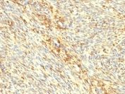 IHC: Formalin-fixed, paraffin-embedded human uterus stained with Transglutaminase 2 antibody.