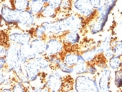 IHC: Formalin-fixed, paraffin-embedded human placenta stained with Transglutaminase 2 antibody.