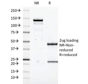 SDS-PAGE Analysis of Purified, BSA-Free Transglutaminase 2 Antibody (clone TGM2/419). Confirmation of Integrity and Purity of the Antibody.