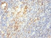 IHC: Formalin-fixed, paraffin-embedded human tonsil stained with Transglutaminase 2 antibody (TGM2/419)