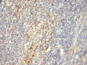 IHC: Formalin-fixed, paraffin-embedded human tonsil stained with TGM2 antibody (SPM592)