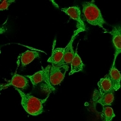 Immunofluorescent staining of PFA-fixed human HepG2 cells with TNF-alpha antibody (green, clone TNFA/1172) and Reddot nuclear stain (red).