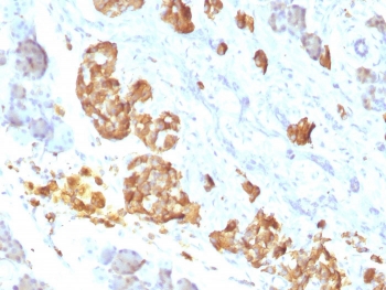 IHC staining of FFPE human pancreas with TNF-a antibody (clone P/T2).~
