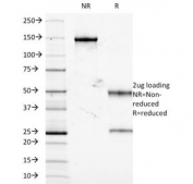 SDS-PAGE Analysis of Purified, BSA-Free TNF-alpha Antibody (clone J2D10). Confirmation of Integrity and Purity of the Antibody.