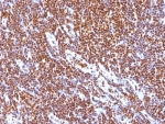 IHC: Formalin-fixed, paraffin-embedded human tonsil stained with SUMO-1 antibody (SUMO1/1188)