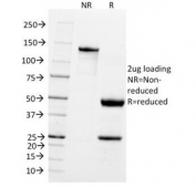 Western blot testing of human brain lysate with PGP 9.5 antibody (clone UCHL1/775). Predicted molecular weight ~25 kDa.