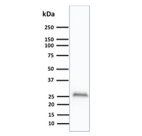 Western blot testing of human brain lysate with UchL1 antibody (clone UCHL1/841). Predicted molecular weight ~25 kDa.~