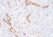 IHC: Formalin-fixed, paraffin-embedded human tonsil stained with VEGF antibody (clone VEGF/1063).