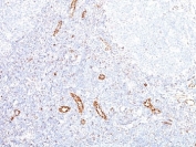 IHC: Formalin-fixed, paraffin-embedded human tonsil stained with VEGF antibody (clone VEGF/1063).