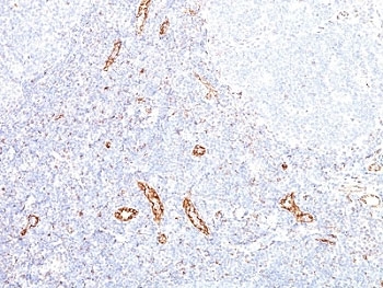 IHC: Formalin-fixed, paraffin-embedded human tonsil stained with VEGF antibody (clone VEGF/1063).