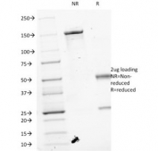 SDS-PAGE Analysis of Purified, BSA-Free VEGF Antibody (clone VEGF/1063). Confirmation of Integrity and Purity of the Antibody.