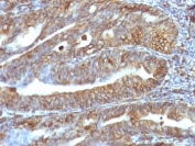 IHC: Formalin-fixed, paraffin-embedded human uterus stained with anti-Vimentin antibody (clone VM1170).