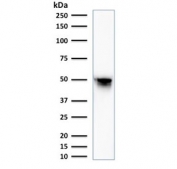 Western blot testing of human HepG2 cell lysate with anti-Vimentin antibody. Predicted molecular weight ~58 kDa.