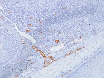 IHC staining of FFPE human tonsil with anti-vWF antibody (clone IIIE2.34). HIER: boil tissue sections in pH 9 10mM Tris with 1mM EDTA f