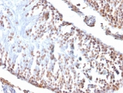 IHC testing of FFPE rat testis with Wilms Tumor 1 antibody (clone 6F-H2). Required HIER: boil tissue sections in pH 9 10mM Tris with 1mM EDTA for 10-20 min followed by cooling at RT for 20 min.