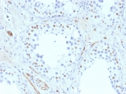 IHC testing of FFPE human testis with Wilms Tumor 1 antibody (clone 6F-H2). Required HIER: boil tissue sections in pH 9 10mM Tris with 1mM EDTA for 10-20 min followed by cooling at RT for 20 min.