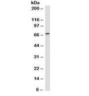 Western blot testing of human Jurkat cell lysate with ZAP-70 antibody (clone 2F3.2).