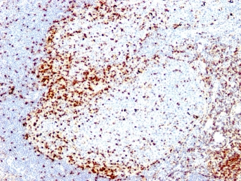 IHC analysis of formalin-fixed, paraffin-embedded human tonsil stained with ZAP-70 antibody (clone 2F3.2).