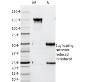 SDS-PAGE analysis of purified, BSA-free ZAP70 antibody (clone SPM362) as confirmation of integrity and purity.